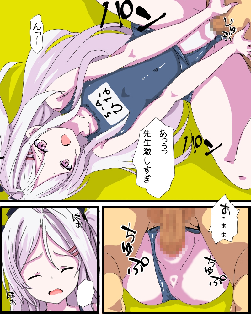 子宮脱アーカイブ