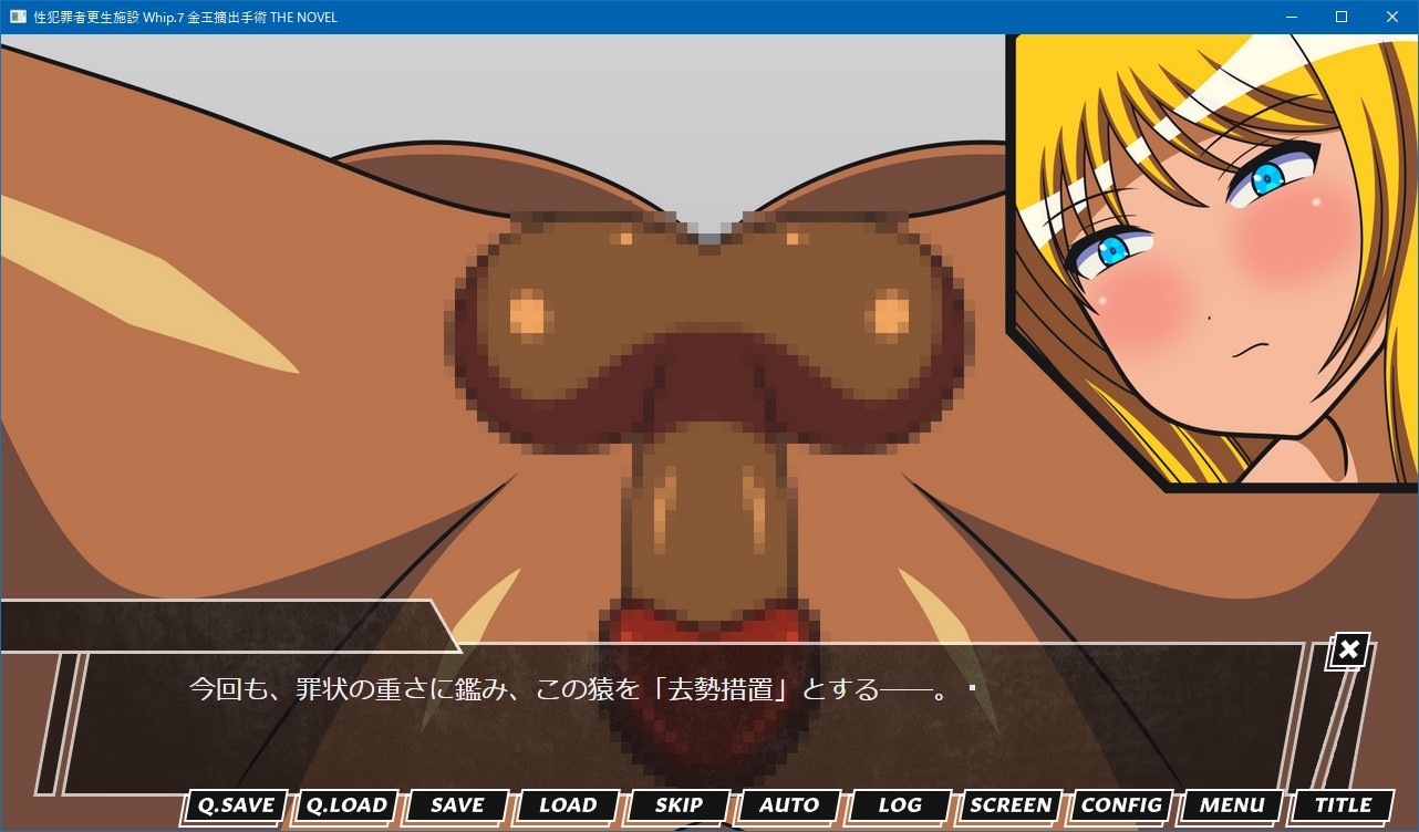 性犯罪者更生施設 Whip.7 金玉摘出手術 THE NOVEL