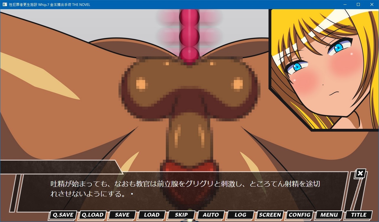 性犯罪者更生施設 Whip.7 金玉摘出手術 THE NOVEL