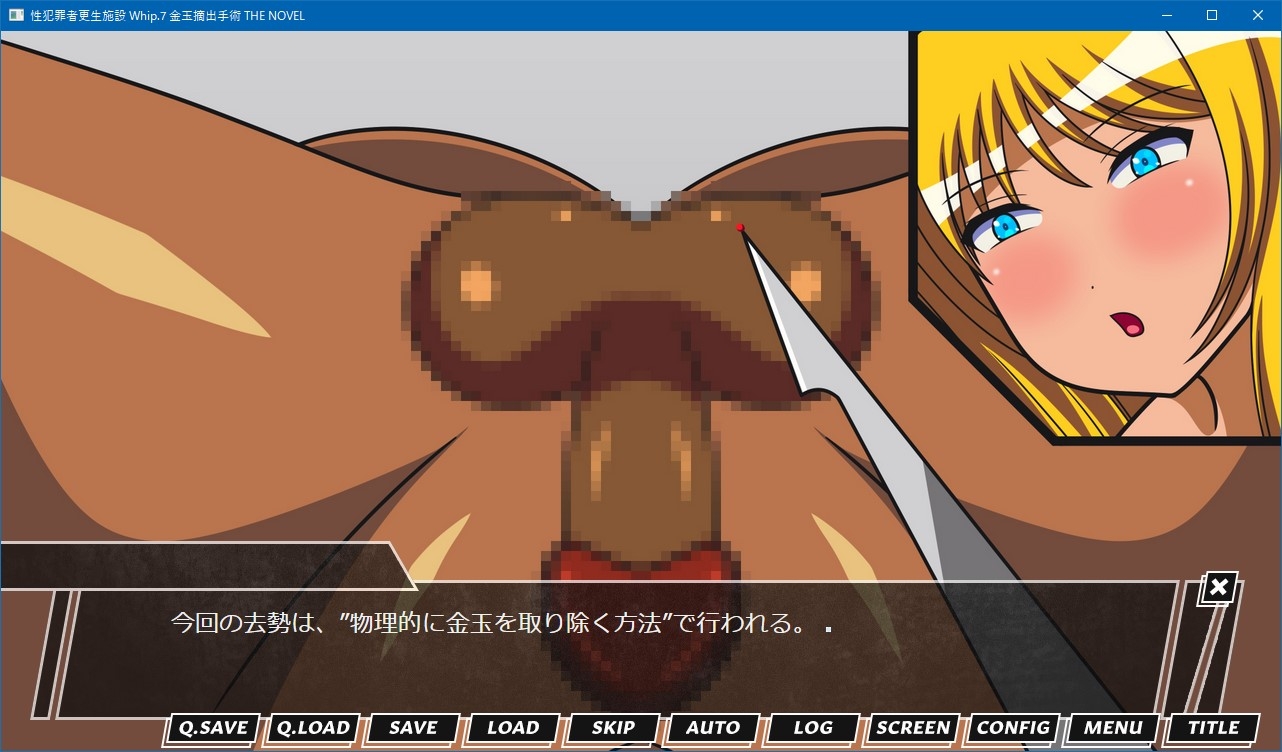 性犯罪者更生施設 Whip.7 金玉摘出手術 THE NOVEL