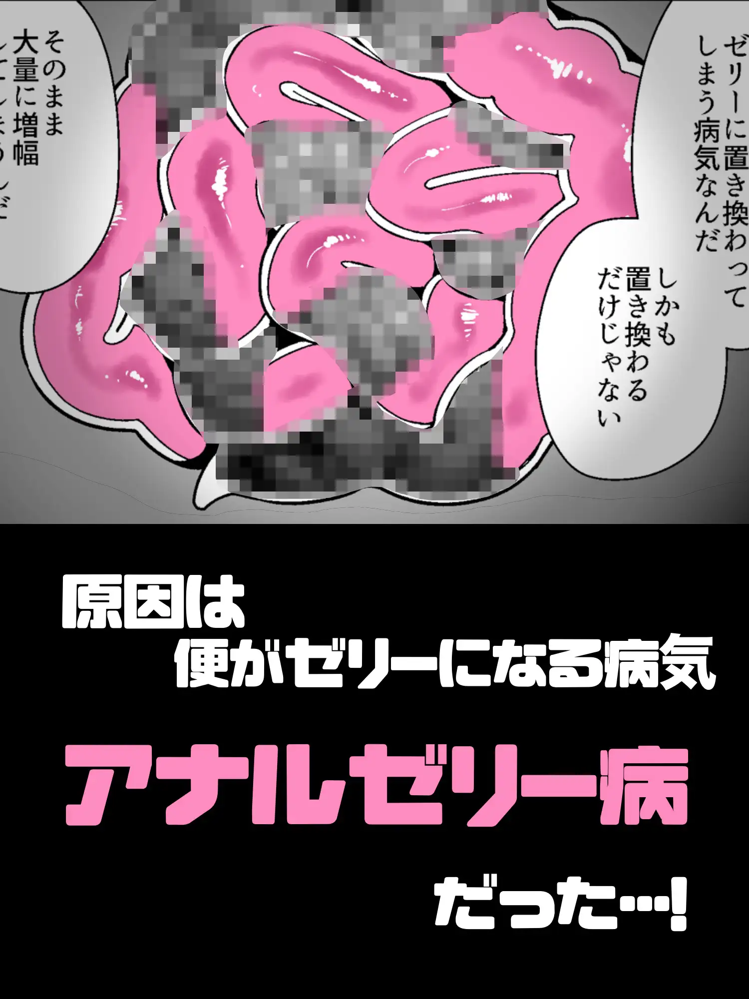 アナルゼリーという病〜人妻OLは我慢も虚しく巨尻からゼリーを吹き出す〜