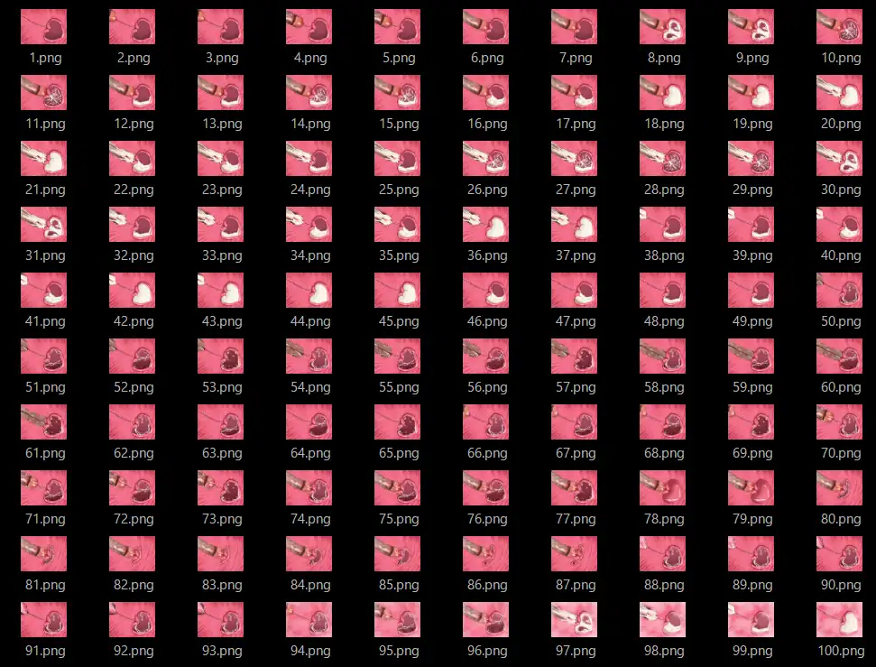 膣内断面図素材3